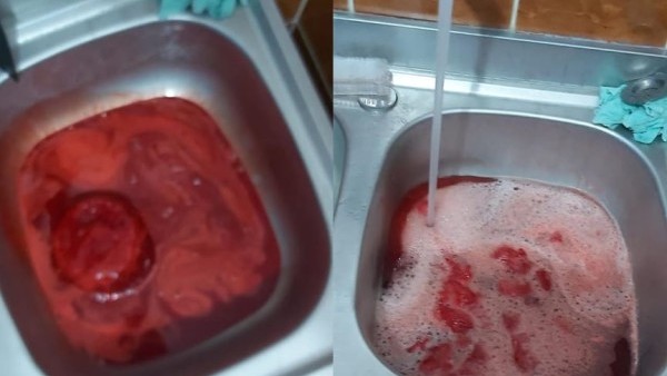 Alerta la spitalul Universitar din Bucuresti „sângele contaminat este aruncat in chiuvete si wc-uri”