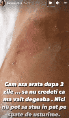 Larisa Udilă a ajuns la spital după ce s-a opărit: ,,Am făcut o criză de nervi, am plâns, am urlat."