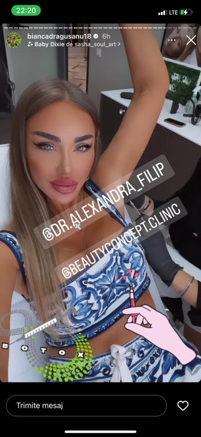 Bianca Drăgușanu, o nouă intervenție estetică, în zona axilei! Motivul pentru care diva a recurs la acest gest