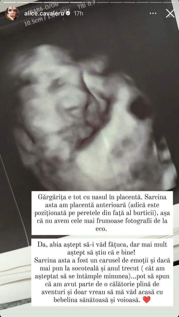 Alice Cavaleru și-a văzut bebelușul în luna a noua de sarcină. Soția lui Vladimir Drăghia a postat imaginile. FOTO