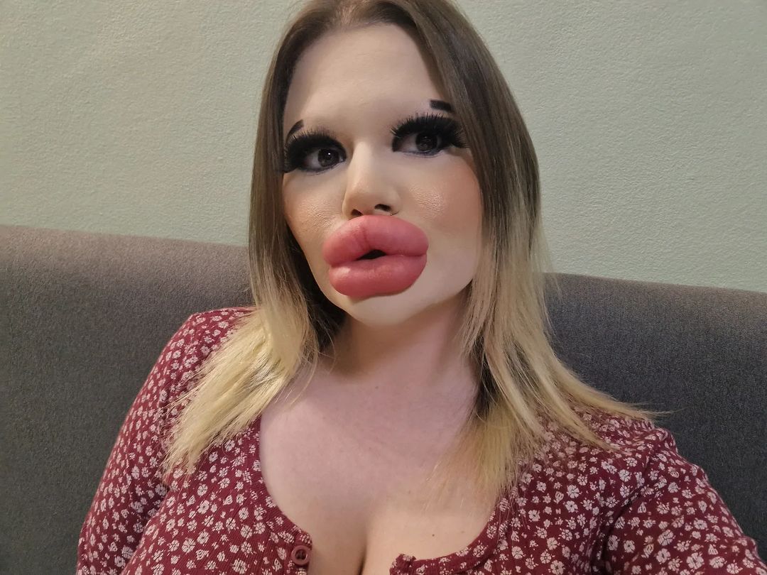Cum arată femeia care a vrut să se transforme în păpușa Bratz. Operațiile estetice au dat greș