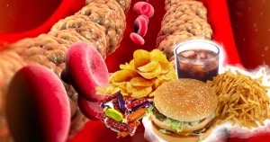 Cum Scădem Rapid Colesterolul – Cel Mai Mare Dusman al Sănătății Românului
